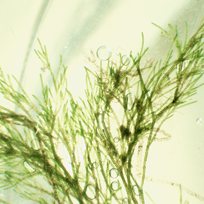 Astalgen, mikroskopische Verggrößerung; Bild